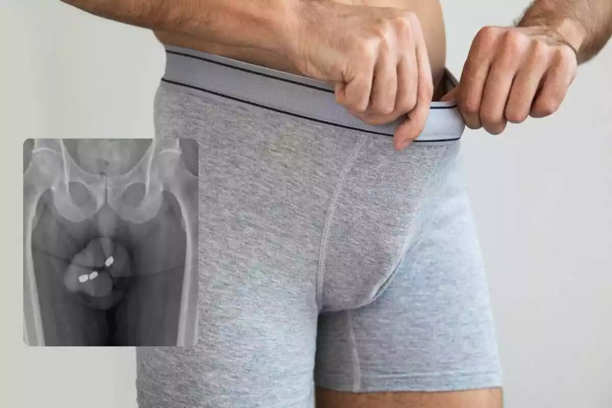 Un home mira el penis en un fotomuntatge amb la radiografia d?un home que s?ha introduït piles pel penis