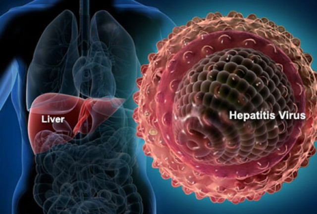 Hepatitiss1liverhepatitisvirus 3