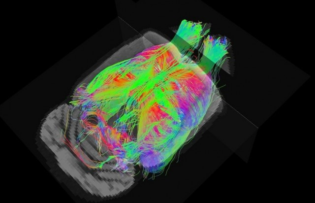 Alzheimer resonancia magntica 10042018