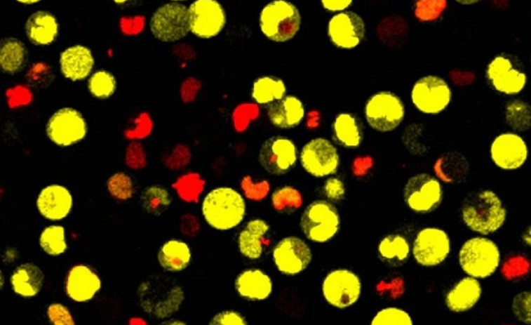 Quan els músculs s'exerciten ajuden les neurones a créixer, segons un nou estudi