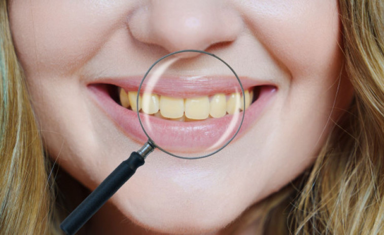 Taques a les dents: les causes principals i com prevenir-les