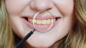 Taques a les dents: les causes principals i com prevenir-les