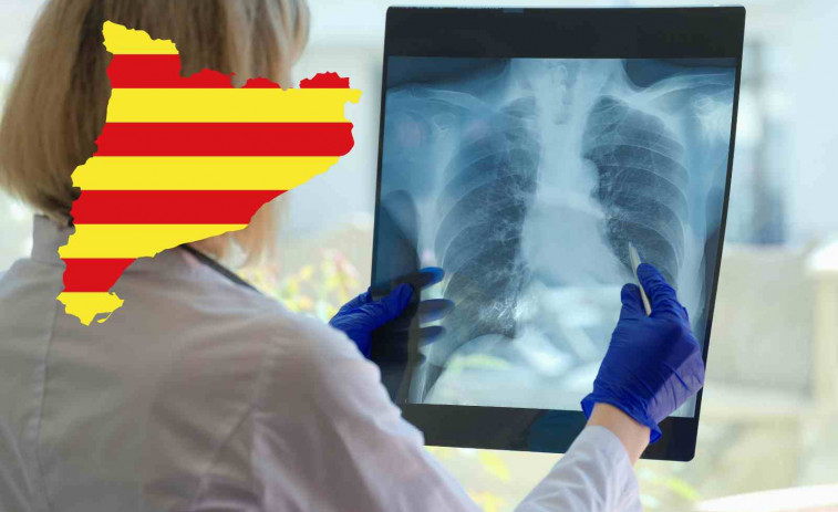 Alarma sanitària! Augmenten els casos de tuberculosi a Espanya i Catalunya lidera el rànquing